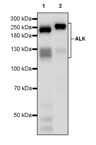 ALK Recombinant Rabbit mAb (SDT-3284)
