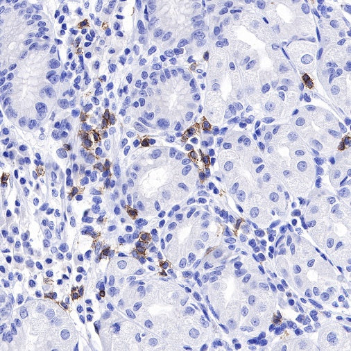 CD20 Recombinant Rabbit mAb (SDT-038-205)
