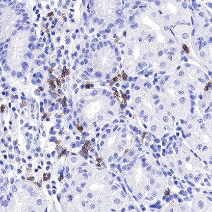 CD20 Recombinant Rabbit mAb (SDT-038-205)