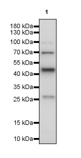 S-RMabMixTM Tri-Methyl Lysine Rabbit mAb