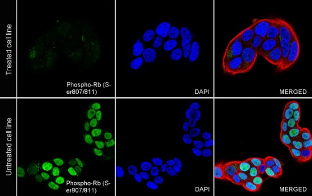 Phospho-Rb (Ser807/811) Recombinant Rabbit mAb (S-2215-52)