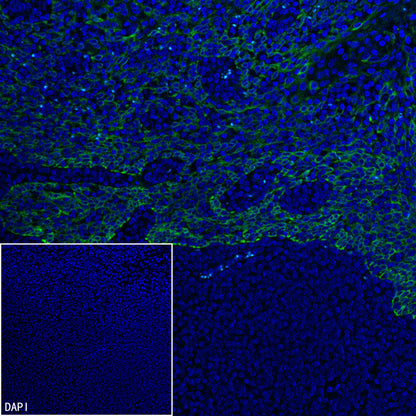 Cytokeratin 1 Recombinant Rabbit mAb (SDT-3225-22)