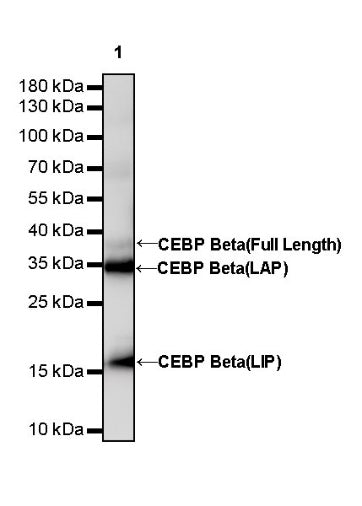 CEBP Beta (C-terminal) Recombinant Rabbit mAb (S-773-48)