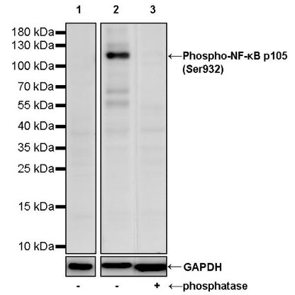 Phospho-NF-κB p105 (Ser932) Recombinant Rabbit mAb (S-1146-117)