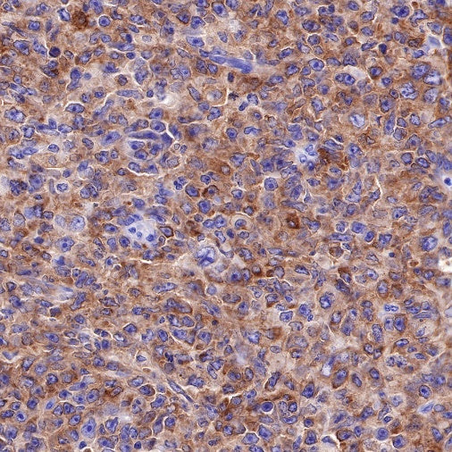 CD25/IL-2Rα Recombinant Rabbit mAb (S-R223)