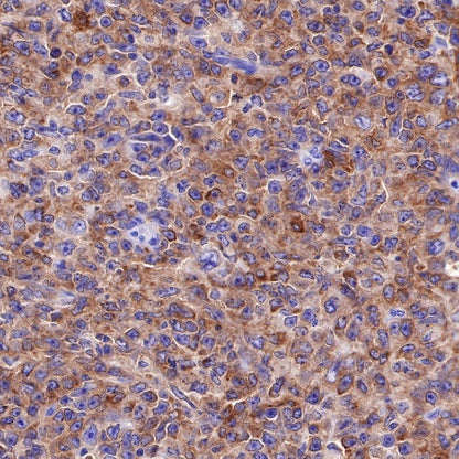 CD25/IL-2Rα Recombinant Rabbit mAb (S-R223)