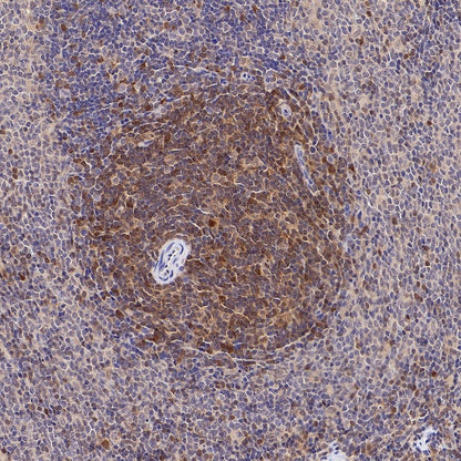 Stat5 Recombinant Rabbit mAb (S-2823-24)