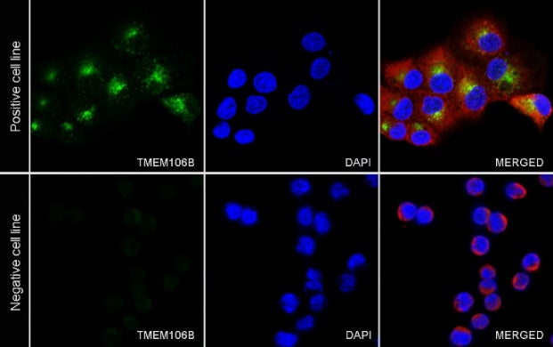 TMEM106B Recombinant Rabbit mAb (S-2362-33)