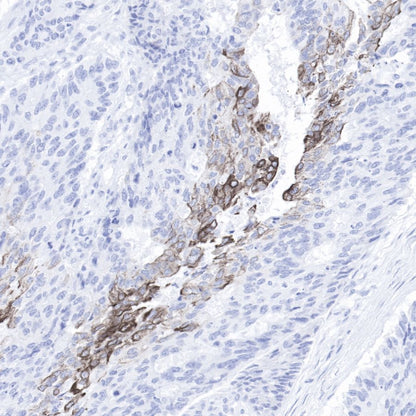 Keratin 20 Recombinant Rabbit mAb (SDT-013-18)