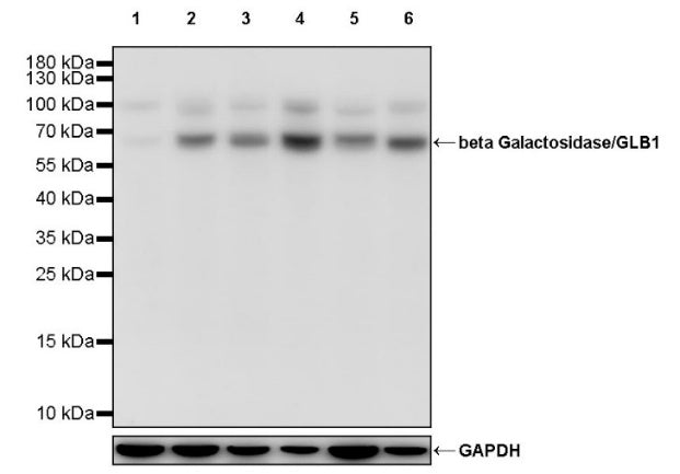 beta Galactosidase/GLB1 Recombinant Rabbit mAb (S-2295-7)
