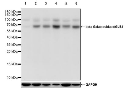 beta Galactosidase/GLB1 Recombinant Rabbit mAb (S-2295-7)