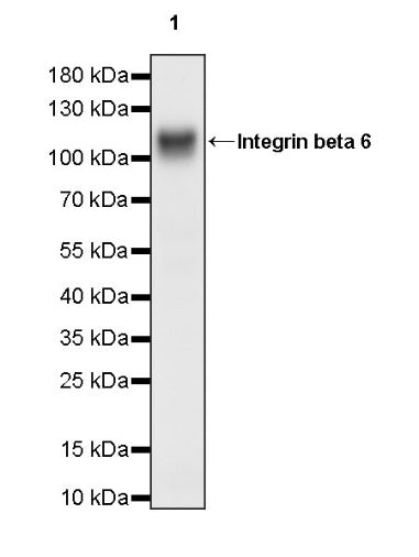 Integrin beta 6 Recombinant Rabbit mAb (SDT-1445-78)