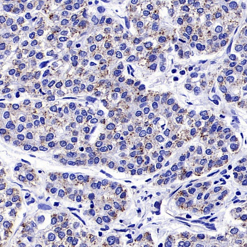 iNOS Recombinant Rabbit mAb (S-2493-61)