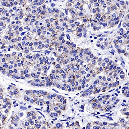 iNOS Recombinant Rabbit mAb (S-2493-61)