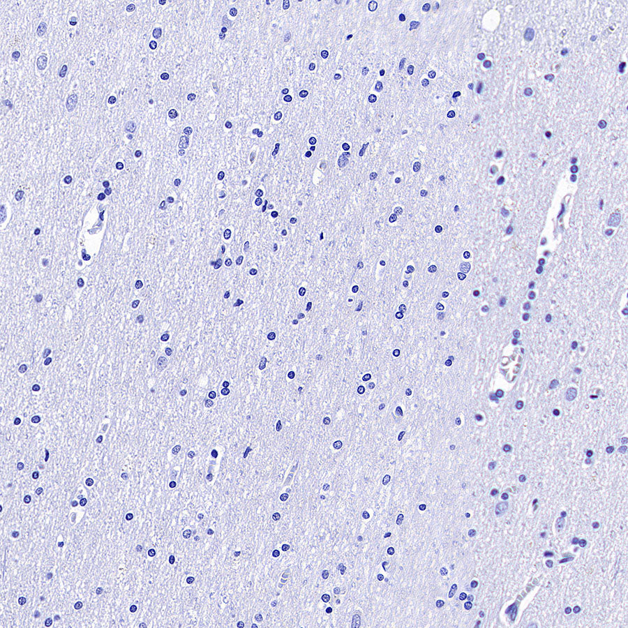 CDCP1 Recombinant Rabbit mAb (S-3437-221)