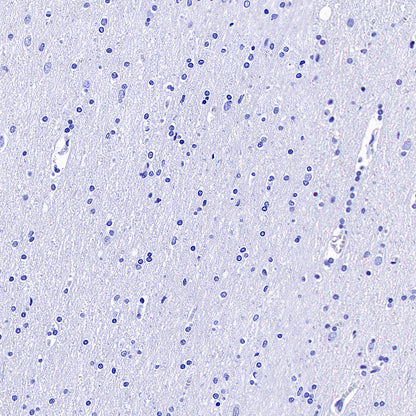 CDCP1 Recombinant Rabbit mAb (S-3437-221)