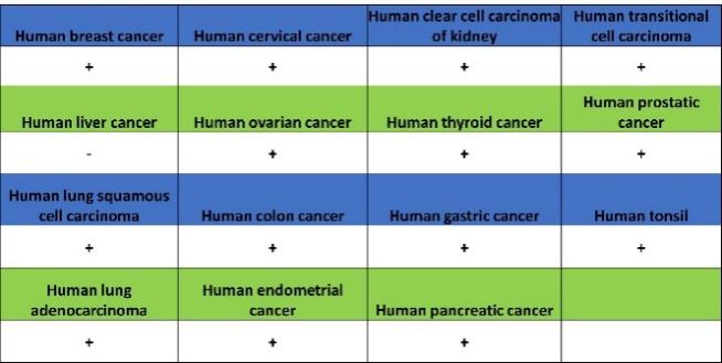 Versican Recombinant Rabbit mAb (S-3770-43)