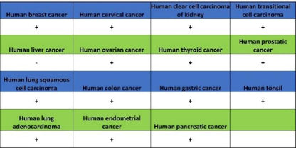 Versican Recombinant Rabbit mAb (S-3770-43)