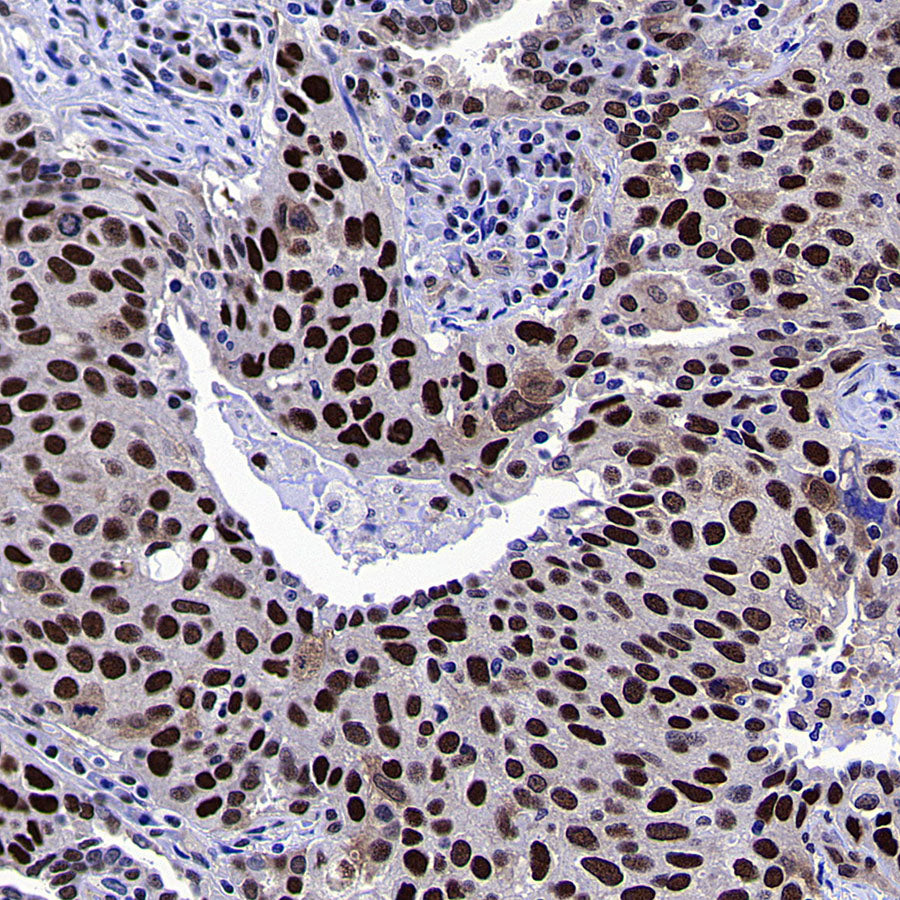 METTL1 Recombinant Rabbit mAb (S-4435-6)