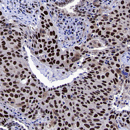METTL1 Recombinant Rabbit mAb (S-4435-6)