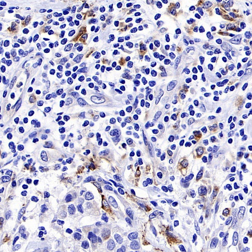 Progranulin Recombinant Rabbit mAb (S-2202-46)