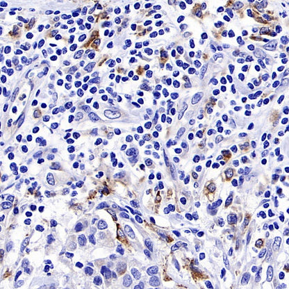Progranulin Recombinant Rabbit mAb (S-2202-46)