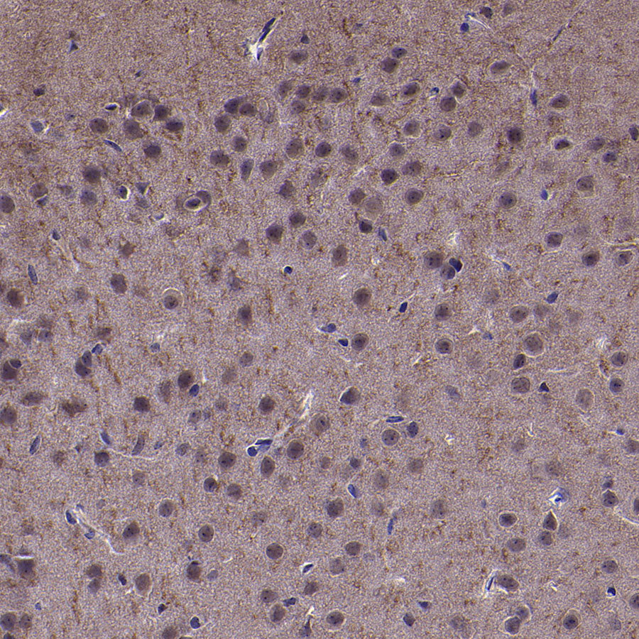 VPS34 Recombinant Rabbit mAb