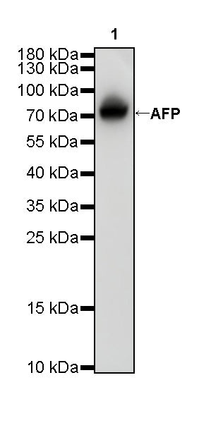 AFP Recombinant Rabbit mAb (SDT-R031)