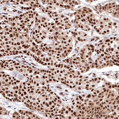 HuR/ELAVL1 Recombinant Rabbit mAb (S-2357-20)