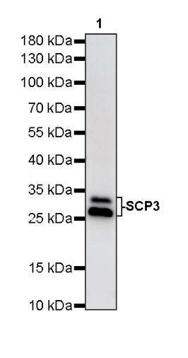 SCP3 Recombinant Rabbit mAb (S-6025)