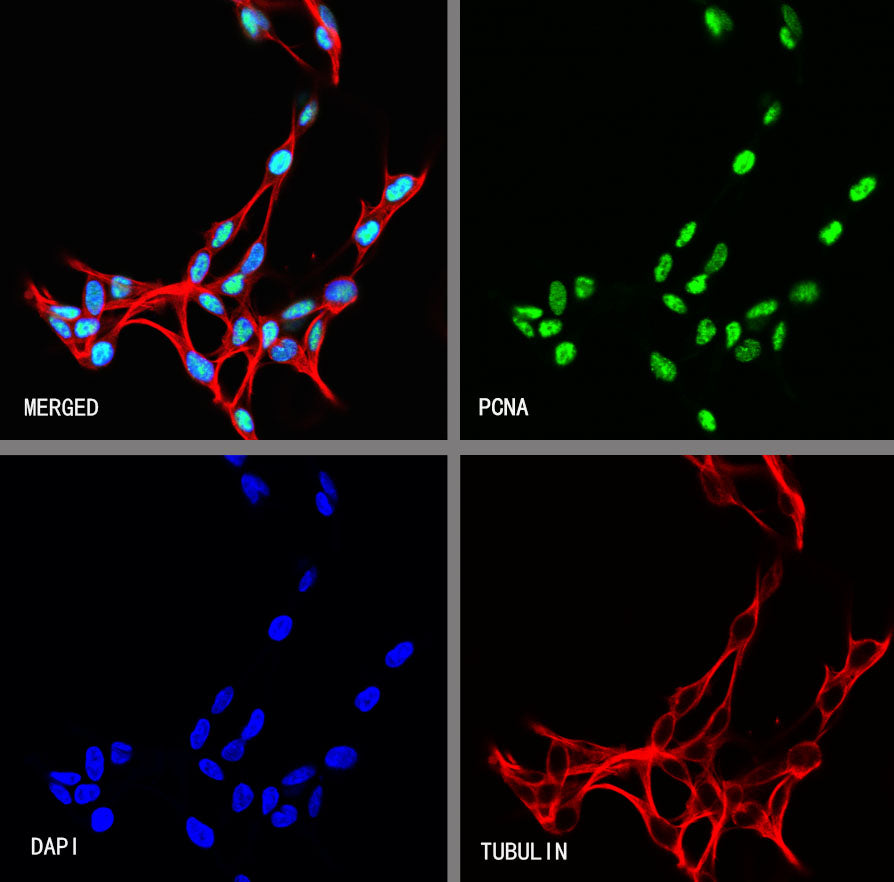 PCNA Recombinant Rabbit mAb (S-5313)