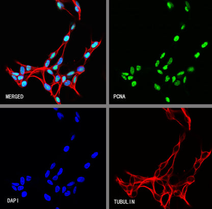 PCNA Recombinant Rabbit mAb (S-5313)