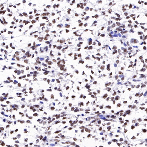 S-RMab® ATRX Recombinant Rabbit mAb (SDT-458-37)