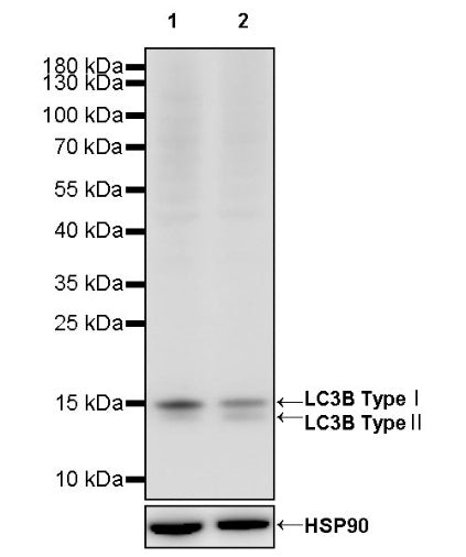 LC3B Recombinant Rabbit mAb (S-1599-142)