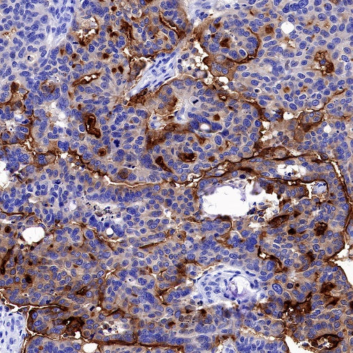ENPP3/CD203c Recombinant Rabbit mAb (S-1632-11)
