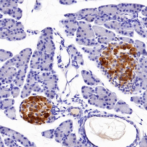 Progranulin/PGRN Recombinant Rabbit mAb (S-1090-110)