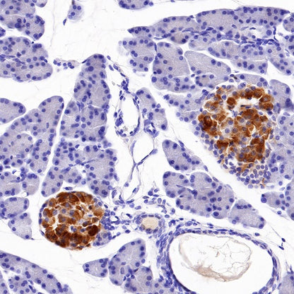 Progranulin/PGRN Recombinant Rabbit mAb (S-1090-110)