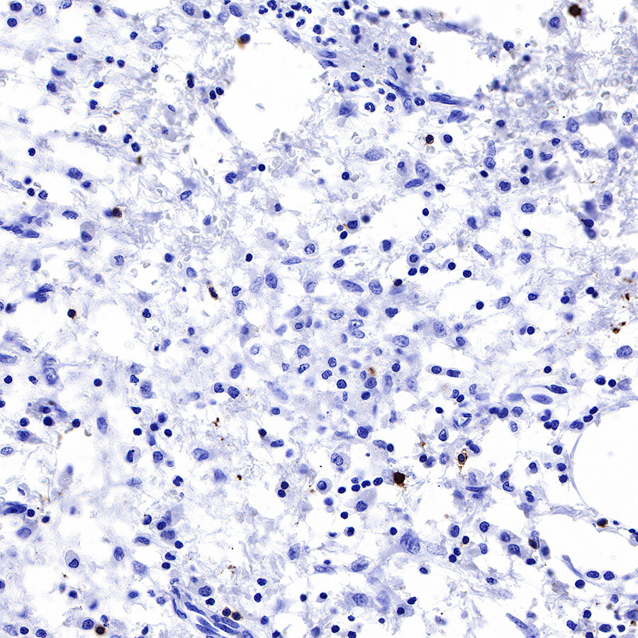 S-RMab® CD20 Recombinant Rabbit mAb,PBS Only (SDT-R133)