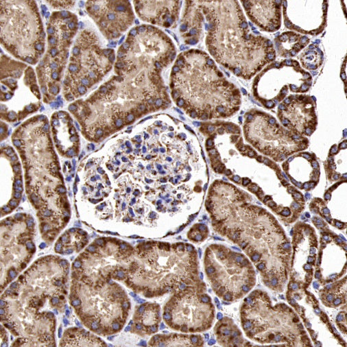 Fumarate hydratase Recombinant Rabbit mAb (SDT-2434-37)