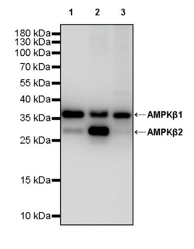 AMPKβ1/2 Recombinant Rabbit mAb (S-2728-26)