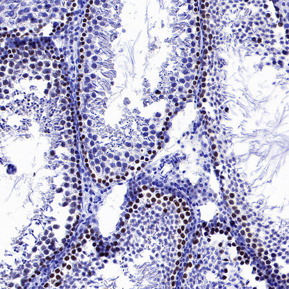 ATAD2 Recombinant Rabbit mAb (S-4145-63)