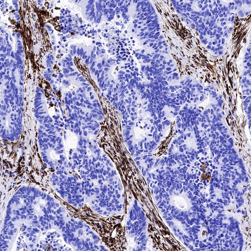 Vimentin Recombinant Rabbit mAb (SDT-029-120)