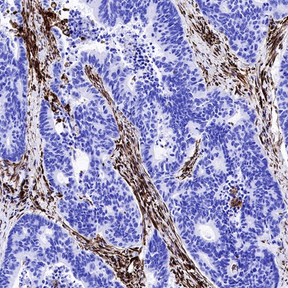 Vimentin Recombinant Rabbit mAb (SDT-029-120)