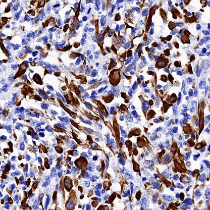 S-RMab® Desmin Recombinant Rabbit mAb (SDT-109-114)
