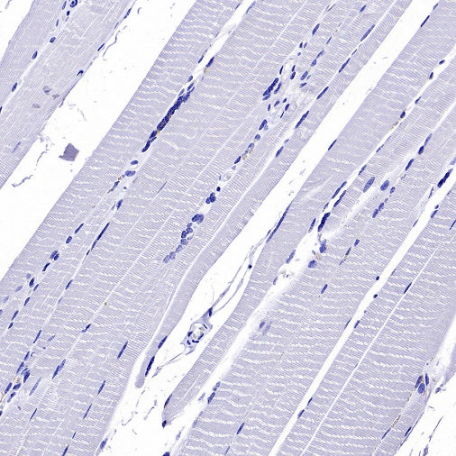 MUC5B Recombinant Rabbit mAb (SDT-2351-40)