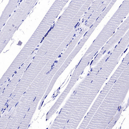 MUC5B Recombinant Rabbit mAb (SDT-2351-40)