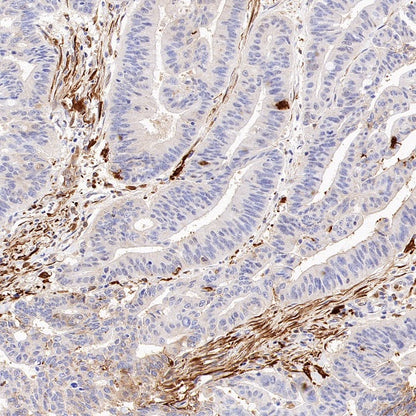 FTH1 Recombinant Rabbit mAb (S-1372-136)