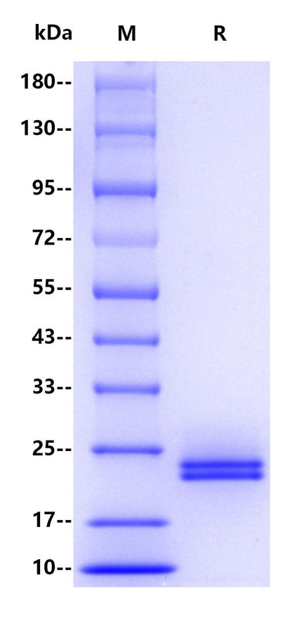 IL-6 His Tag Protein, Human