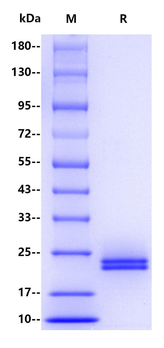 IL-6 His Tag Protein, Human