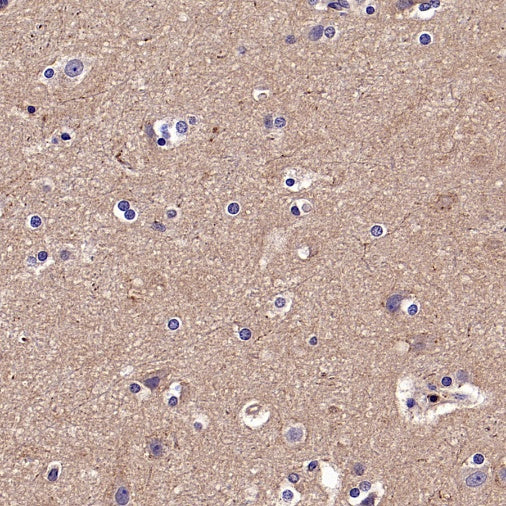 TYK2 Recombinant Rabbit mAb (S-2740-165)